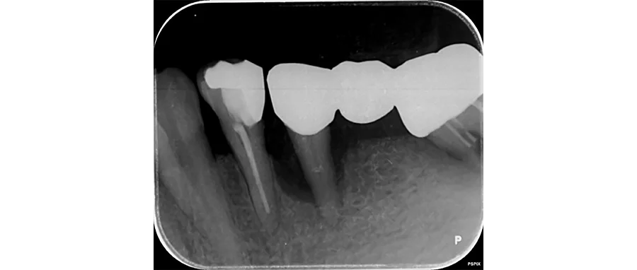 CASE.03